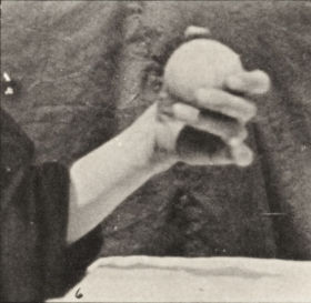 Plate 534 Movement of the hand lifting a ball. — figure reference